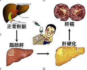 北京的贾先生使用文山三七来清理肝脏